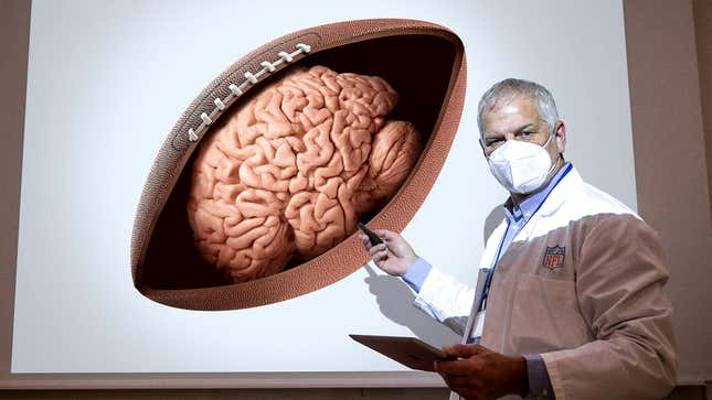 Image for article titled NFL Scientists Study Effects Of CTE By Dissecting Brain Of Pro Football