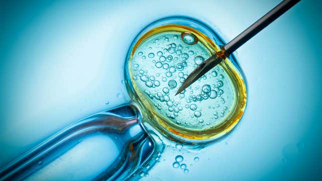 Image for article titled Quiz: How Much Do You Know About IVF?