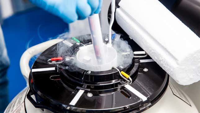 Image for article titled Quiz: How Much Do You Know About IVF?